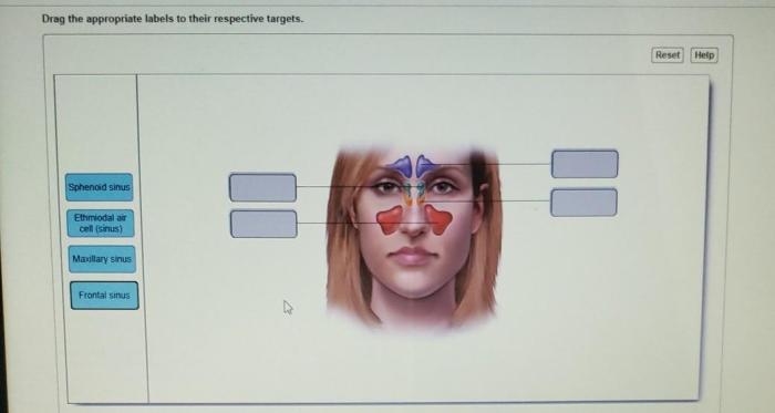 Appropriate drag labels targets respective their labeling activity chegg complete transcribed text show